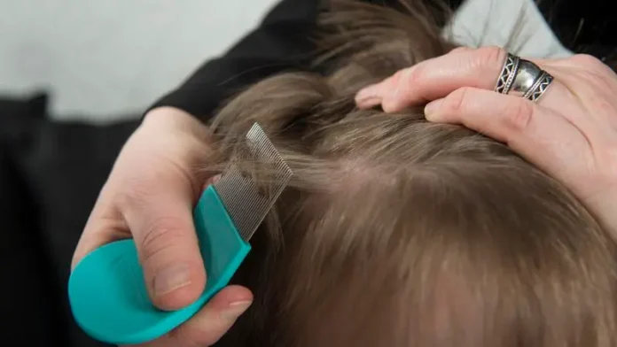 mp11008867-checking-for-lice.webp.webp